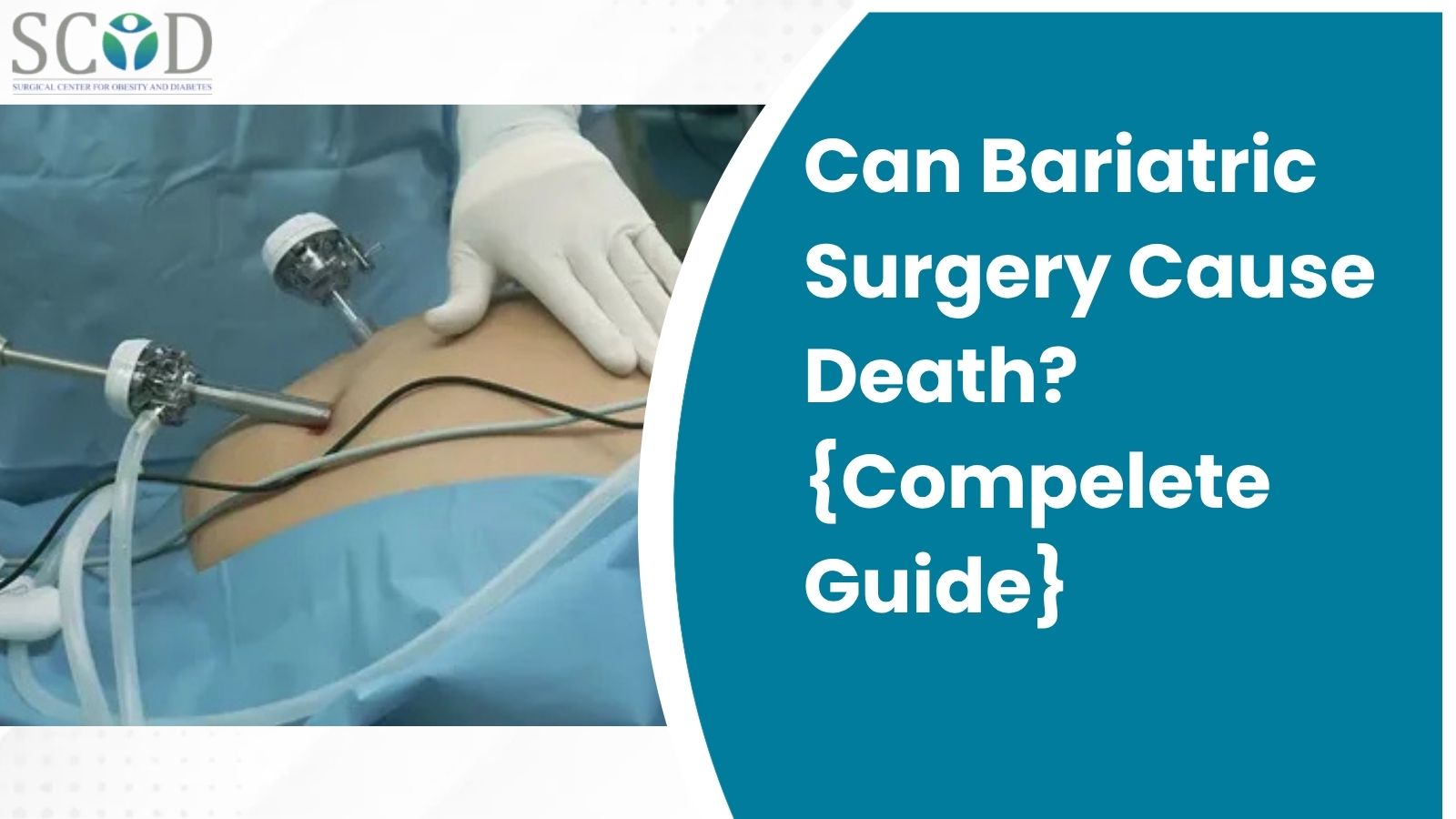 Can Bariatric Surgery Cause Death?