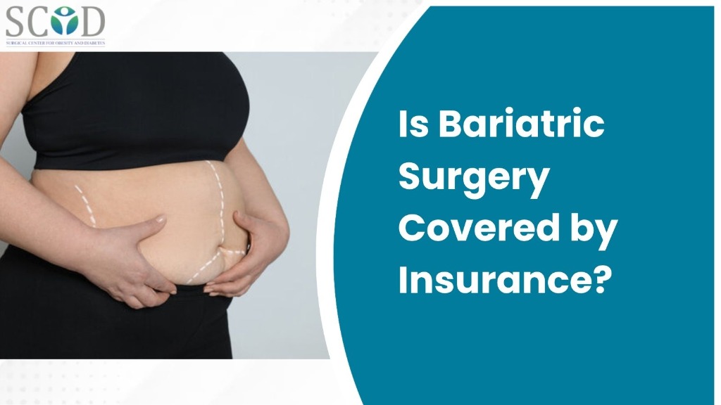 Is Bariatric Surgery Covered by Insurance?