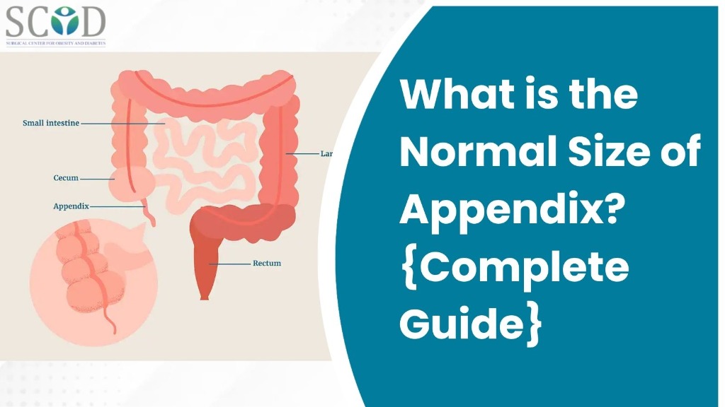 What is the Normal Size of Appendix? {Complete Guide}